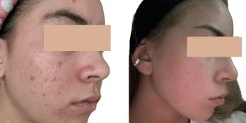 New_Project__22_-removebg-preview-1-1